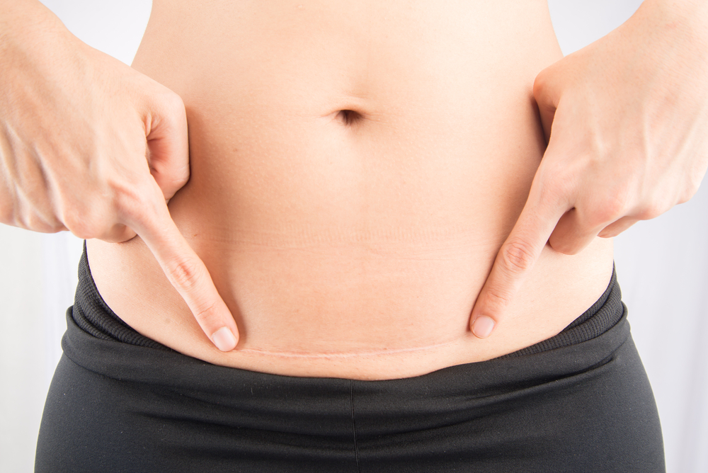 5 Truths About Post Baby Bodies