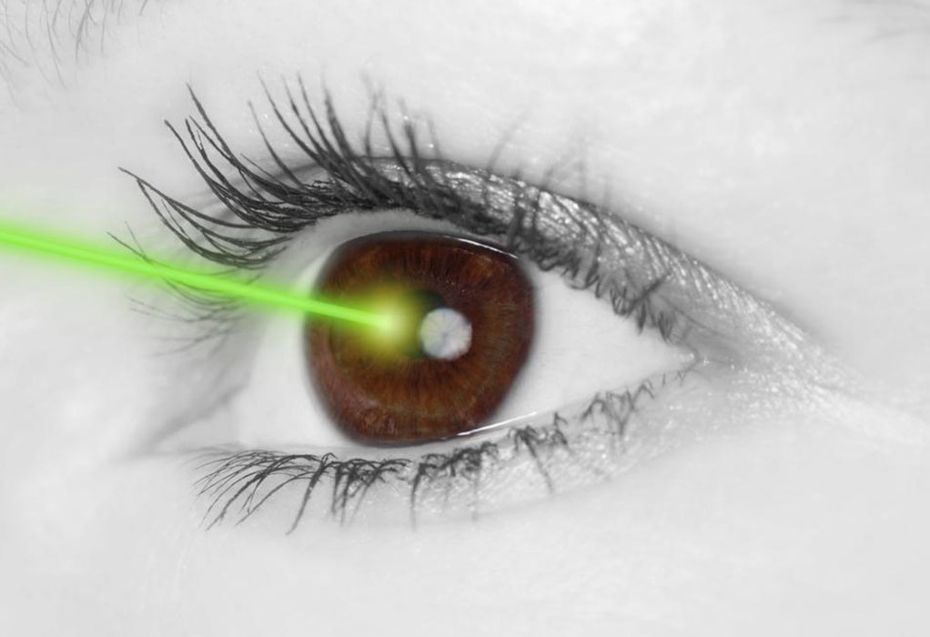 Costo y procedimiento de la cirugía ocular Lasik