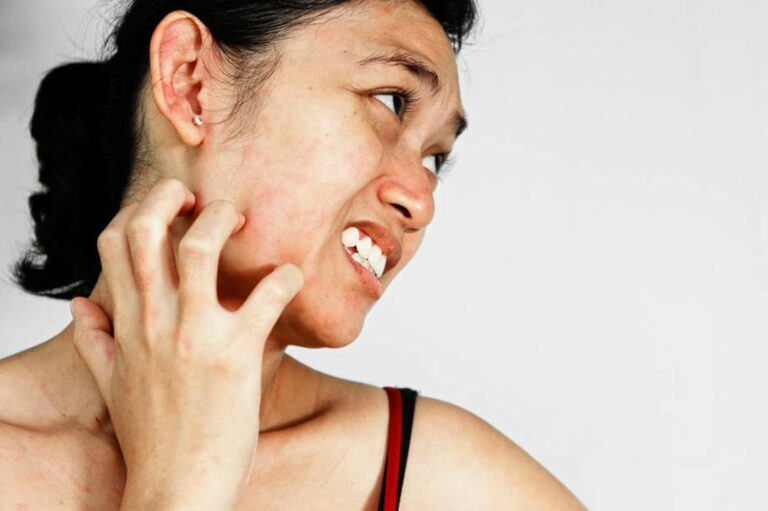 7 easy and useful ways to manage itchy skin