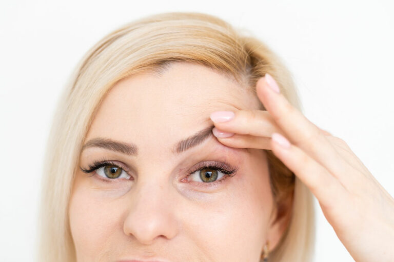 Management Options to Fix Droopy Eyelids