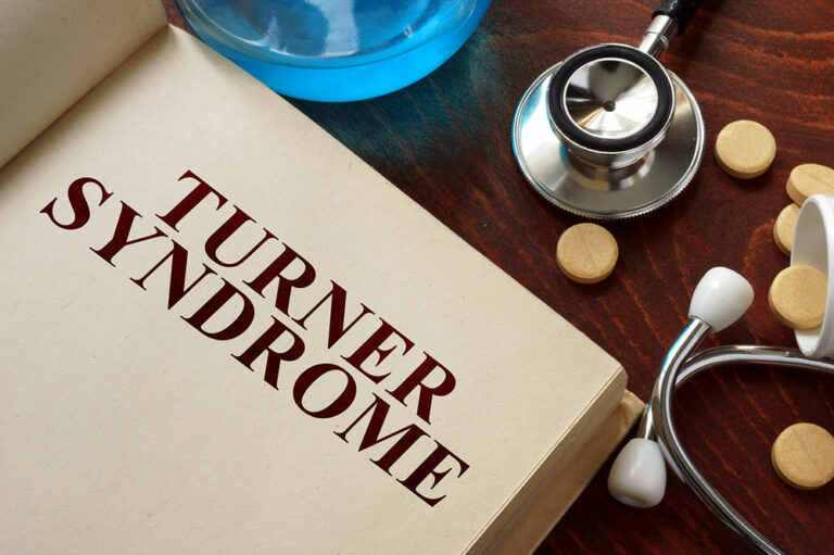 Turner Syndrome &#8211; Causes, Symptoms, and Management