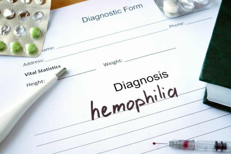 Must Know Facts About Hemophilia