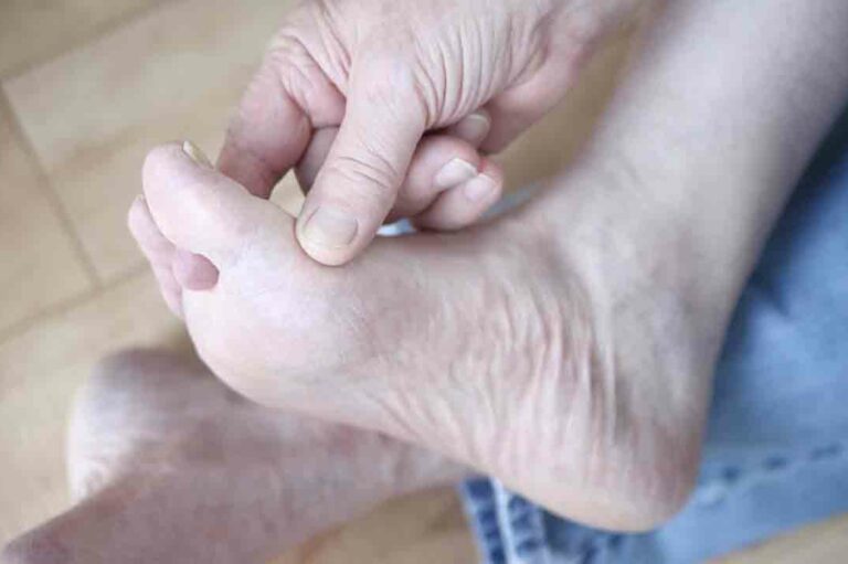 Managing Gout Foot Pain Effectively