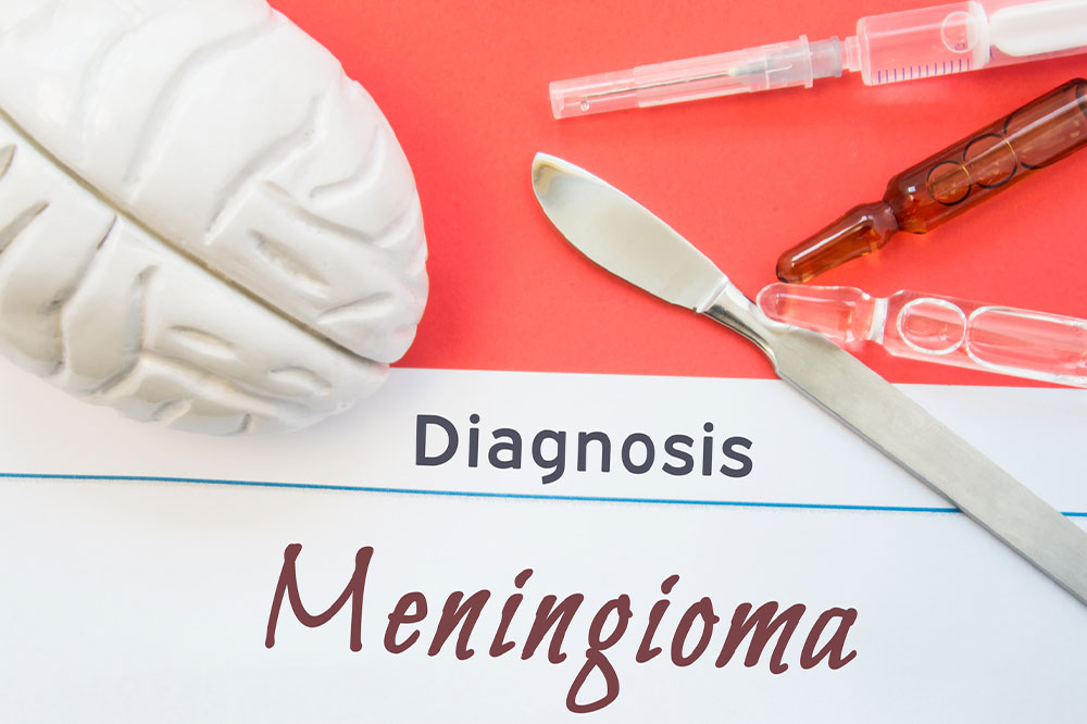 Meningioma &#8211; Symptoms, Causes, Diagnosis, and More