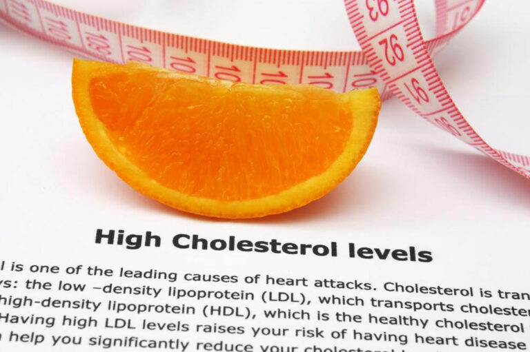 Natural Methods to Reduce Cholesterol Levels