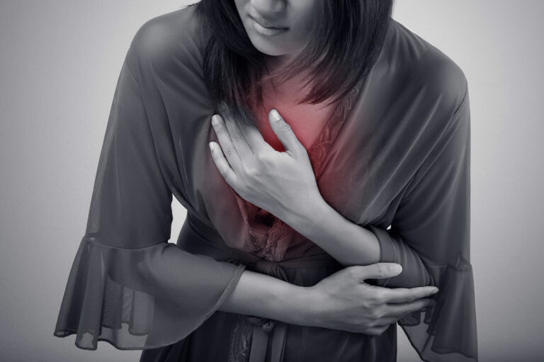 Natural Remedies to Treat Heartburn