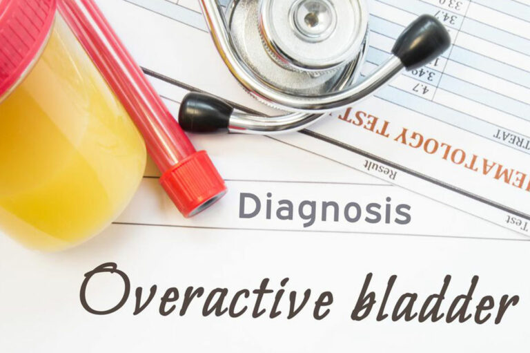 Natural Ways to Deal with an Overactive Bladder