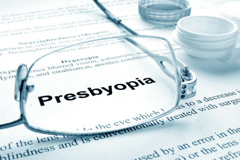 Natural remedies and lifestyle changes for presbyopia