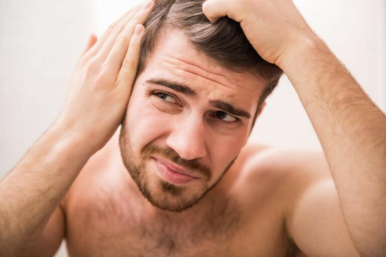 Natural remedies for baldness that you should try