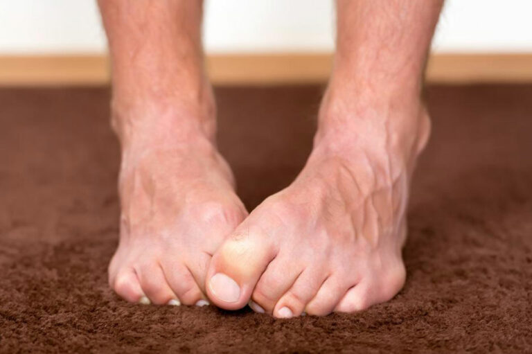 Neuropathy Foot Pain &#8211; Symptoms, Causes, Treatments and More