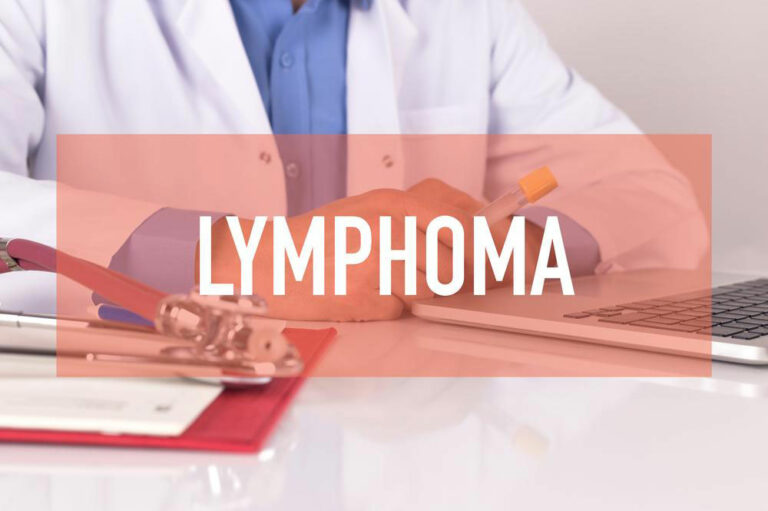 Non Hodgkin Lymphoma treatment &#8211; Symptoms, causes and more explained