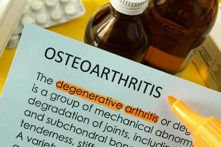 Osteoarthritis: Causes, symptoms, and treatments