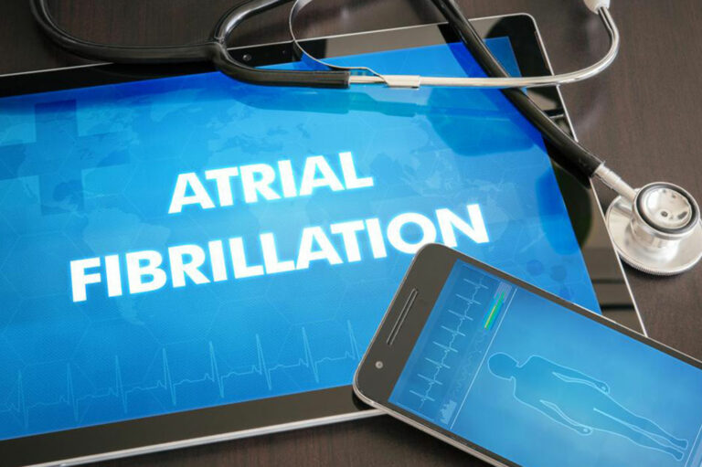 Atrial Fibrillation Treatment Options That Can Save Your Heart and Life