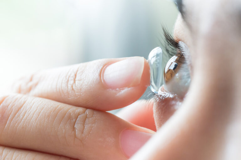 A Brief Overview Of Contact Lenses