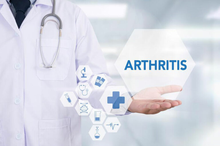 A brief overview of arthritis