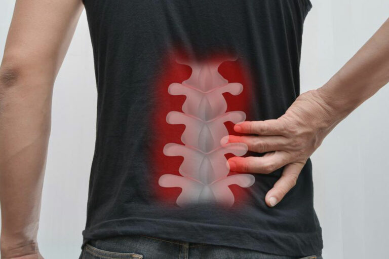 A brief overview of spinal fusion surgery