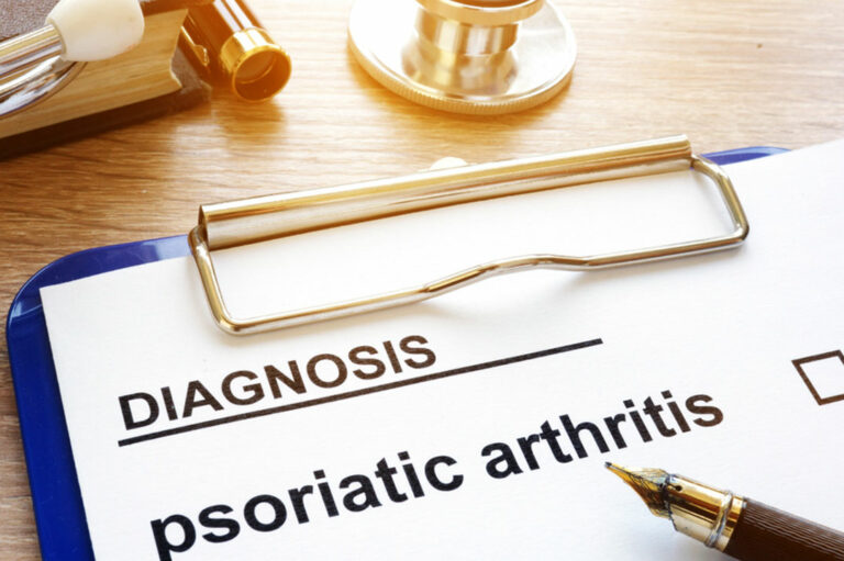 A guide to the symptoms of psoriatic arthritis