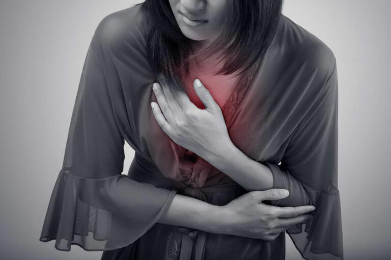 All You Need to Know about Heartburn Symptoms