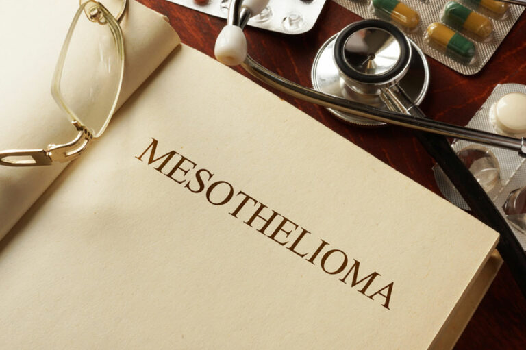 All you need to know about mesothelioma and its symptoms