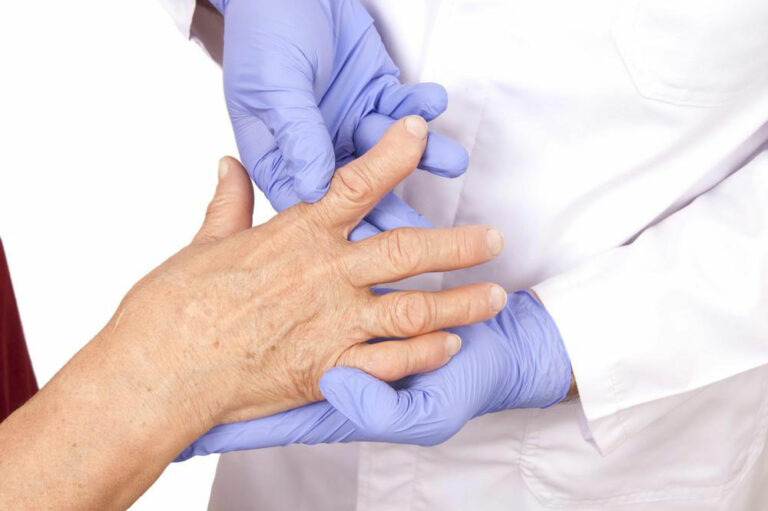 An Overview On Rheumatoid Arthritis