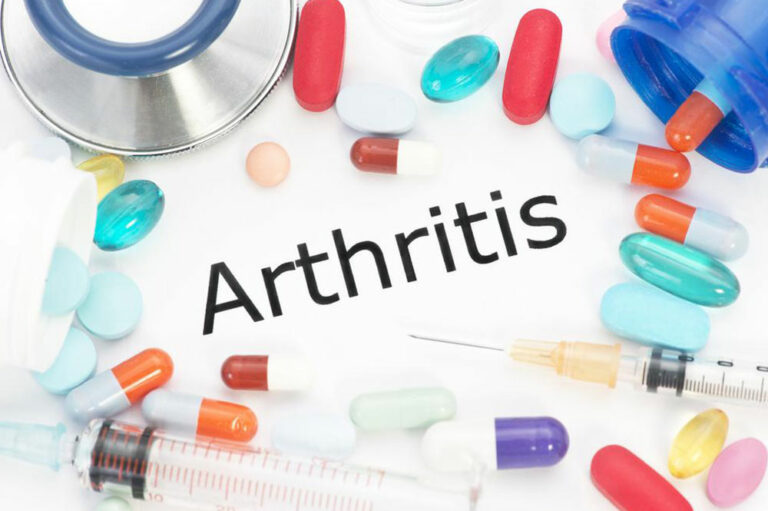 Arthritis &#8211; Classification and treatment