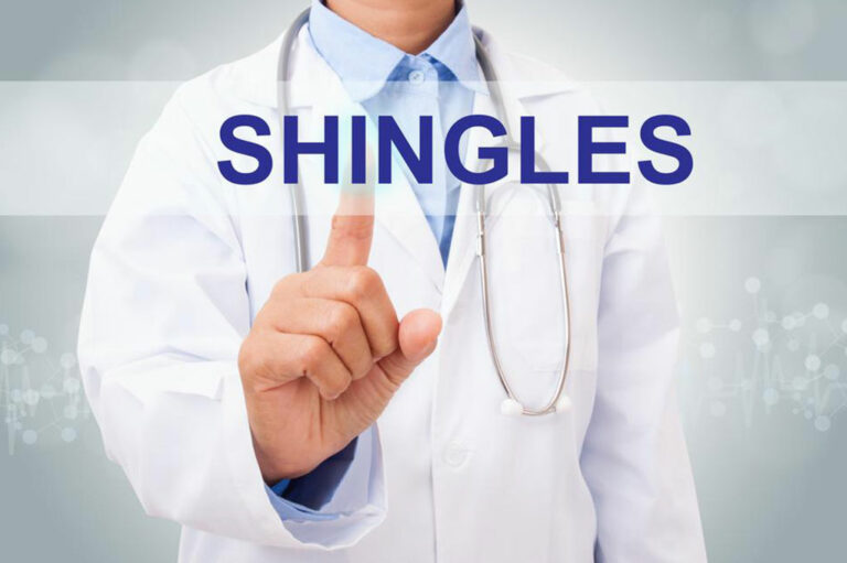 Best Treatment For Shingles Using Shingle Relief Creams