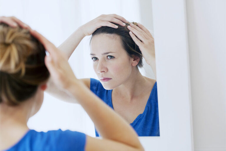 Best Vitamins for Preventing Hair Loss