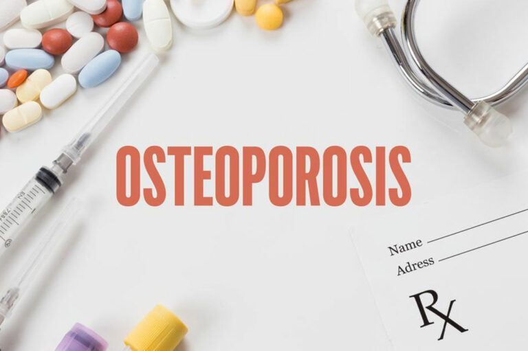 Bone density testing &#8211; An important diagnostic tool for osteoporosis