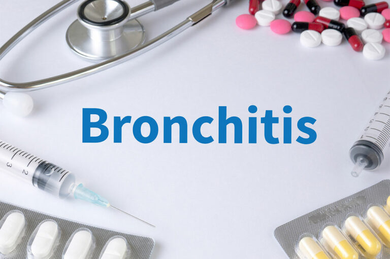 Bronchitis &#8211; Top Remedies and Management Options