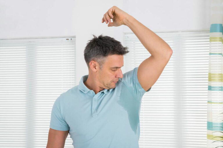 Causes, Complications, and Treatments for Excessive Sweating