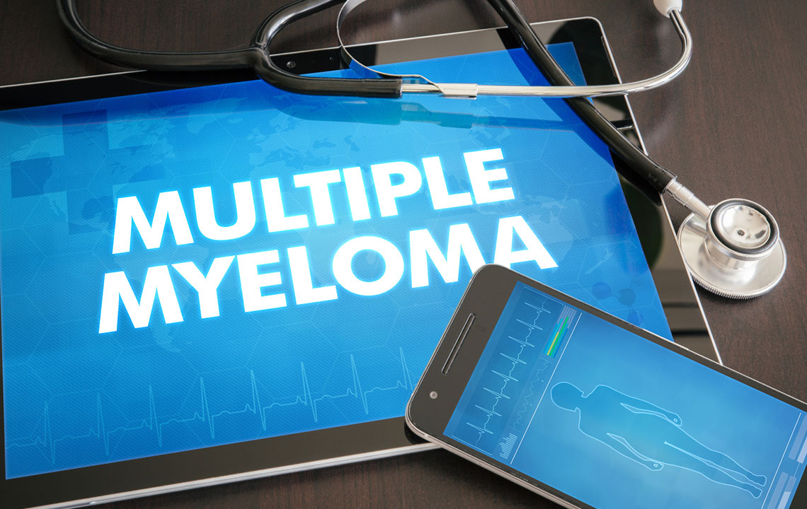 Causes, Risk Factors, and Prevention of Multiple Myeloma