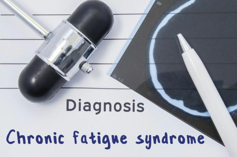 Causes, Symptoms, and Treatments for Chronic Fatigue Syndrome