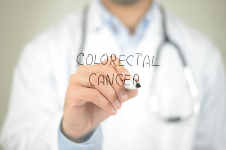 Causes and Diagnosis of Colorectal Cancer