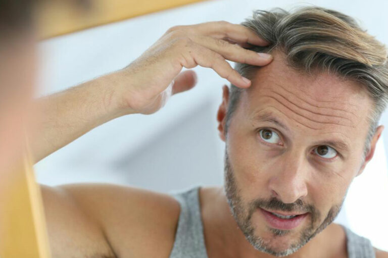 Causes and remedies of hair loss