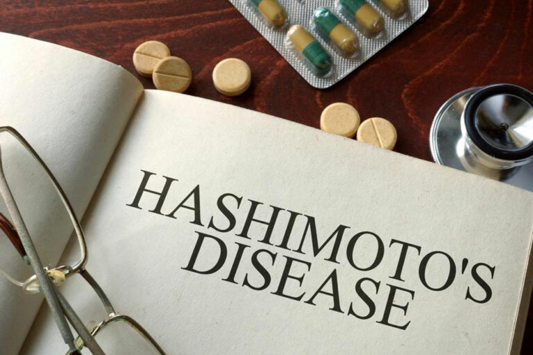 Causes and symptoms of hashimotos disease