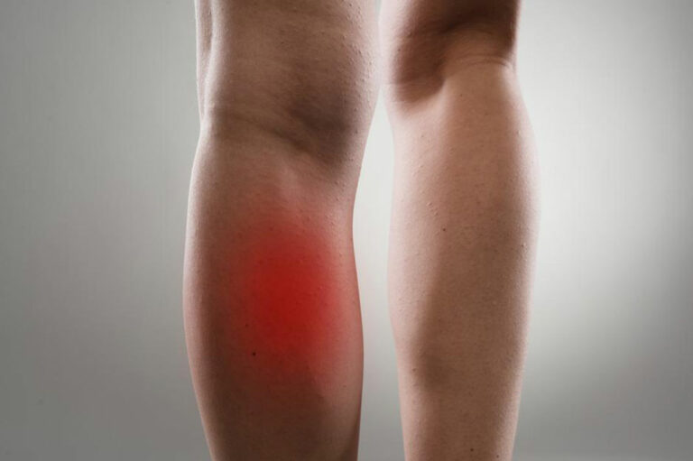 Common Causes and Treatments of Leg Muscle Pain