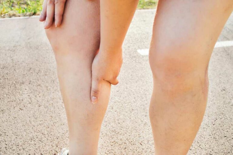 Common Symptoms of Deep Vein Thrombosis