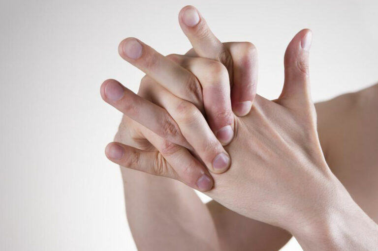 Common differences between rheumatoid arthritis and lupus