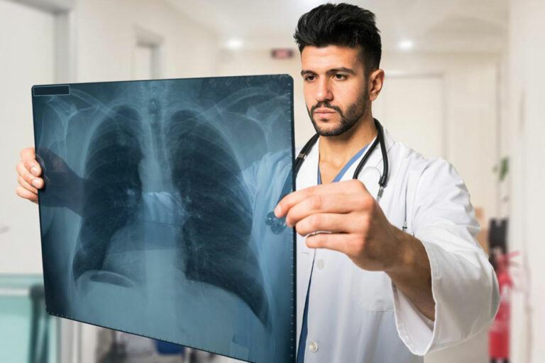 Common pulmonary embolism symptoms that you should be aware of