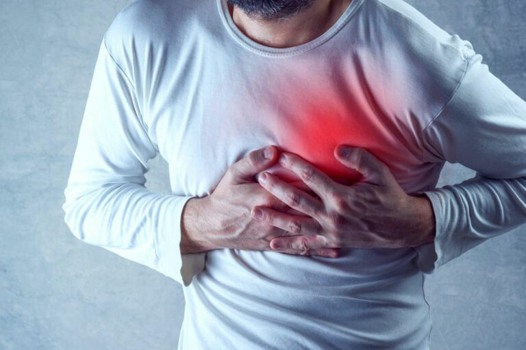 Common triggers and natural treatments of congestive heart failure