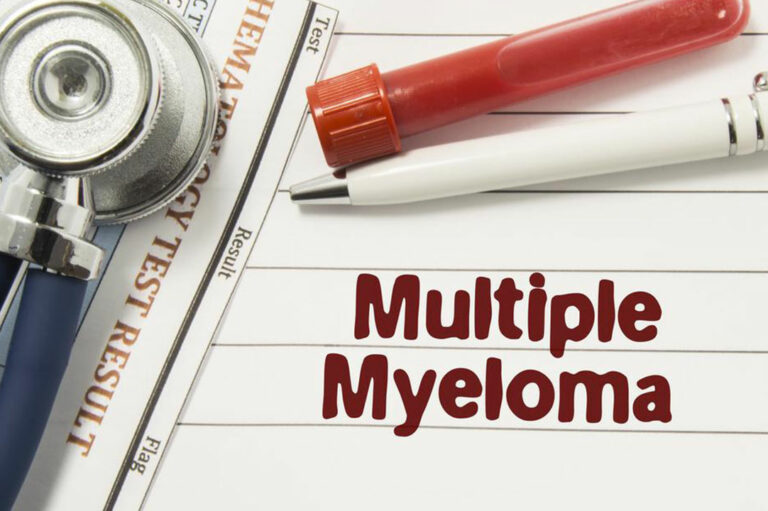 Dealing with multiple myeloma &#8211; Things you should know about