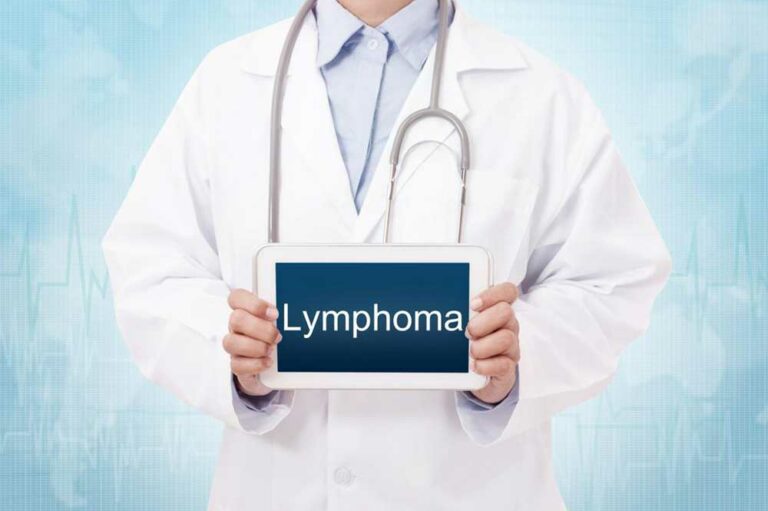 Different Types of Lymphoma You Should Know about