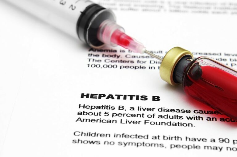 Do You Have These Hepatitis B Symptoms