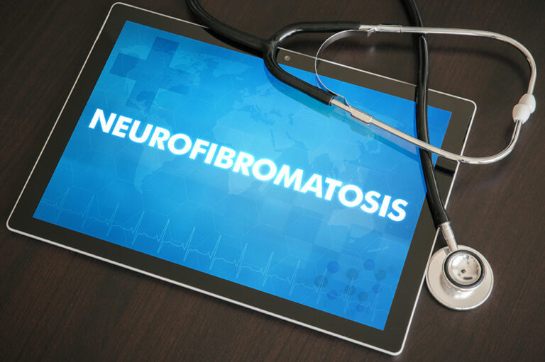 Doctor-recommended treatments for neurofibromatosis