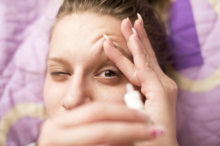 Dry Eyes &#8211; Causes, Symptoms, and Treatments