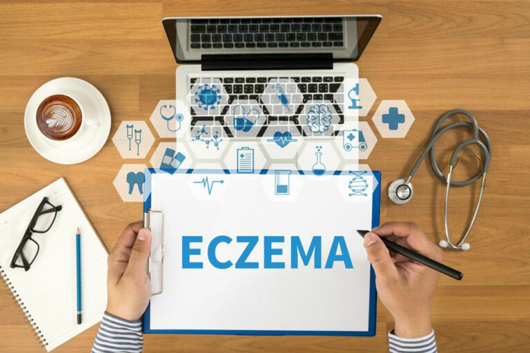 Everything you need to know about eczema