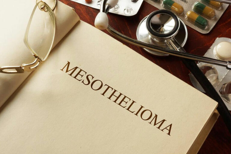 Everything you should know about Mesothelioma