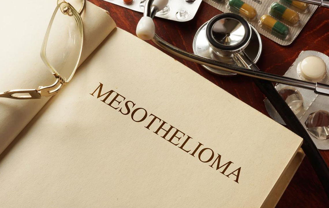 Everything you should know about Mesothelioma