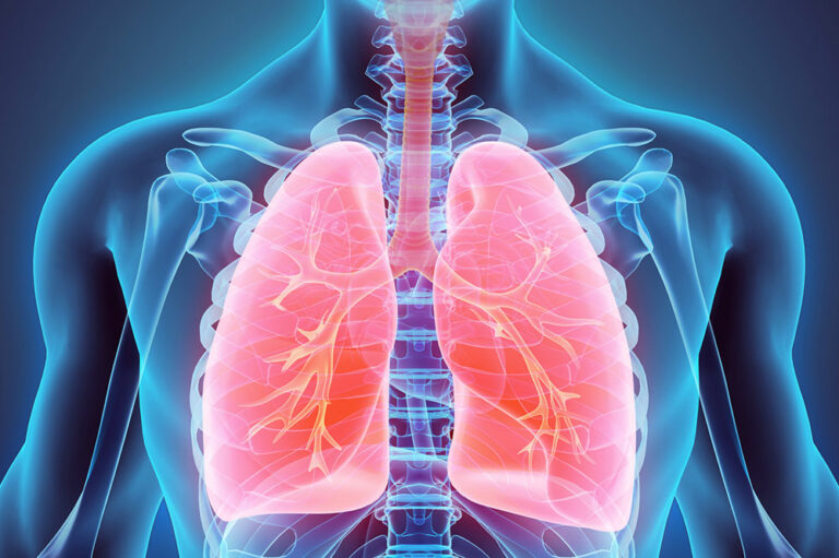 Everything you should know about lung cancer