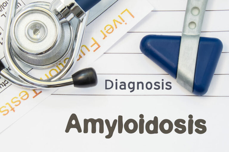 Everything About the Different Types of Amyloidosis